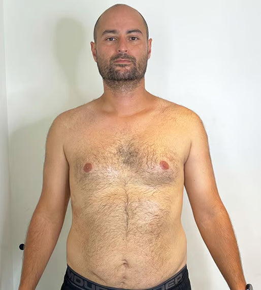 Before transformation